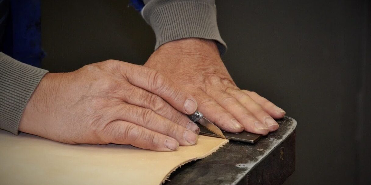 RS3PE症候群｜高齢者に急性発症する左右対称性関節炎と圧痕性浮腫の医学的解説